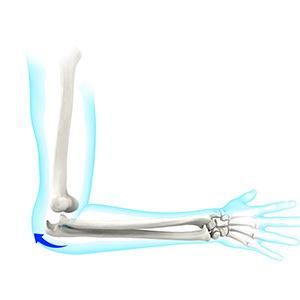 Elbow Instability