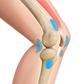 Knee Joint Bursa Infection