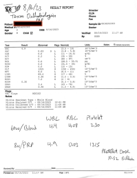 All PRP is NOT the SAME!  Does your doctor know your PRP dose?