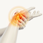 Do You Have Wrist Osteoarthritis? Orthobiologics May Be Able to Help.