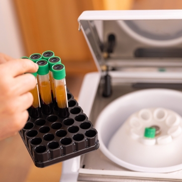 How Regenerative Medicine Boosts Your Body’s Ability to Heal Itself