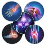 Regenerative Medicine Updates: Using Platelet Rich Plasma (PRP) or Bone Marrow Concentrate (BMC) For Joint Pain