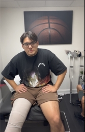 Stem Cell Injection For Anterior Cruciate Ligament (ACL) Tear?  Yes...9 years later