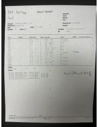 The Arthrex ACP Max Platelet Rich Plasma Bench Test Is Done!