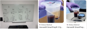 The Globus/Terumo/ Harvest Smartprep3 PRP Bench Test