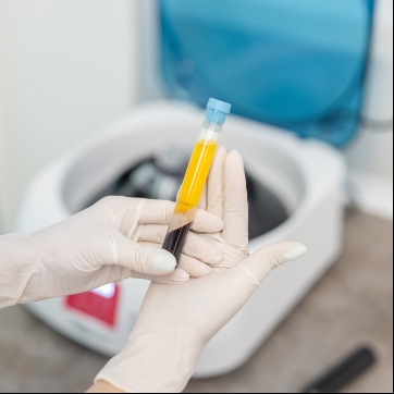 Why Texas Orthobiologics is the Best Place for PRP Therapy