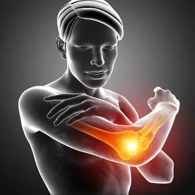 Elbow pain — Texas Orthobiologics