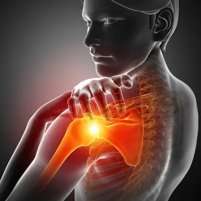Shoulder pain — Texas Orthobiologics