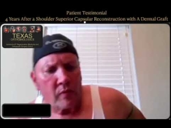 Massive Rotator Cuff Tear? Options besides joint replacement? Yes! Superior Capsular Recon...