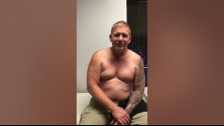 Patient review: 6 wks after Rotator Cuff Repair with Regenenten augmentation.