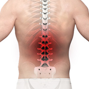 Picture of Chronic Back Pain