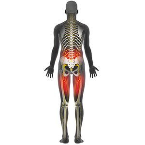 Picture of Leg Pain