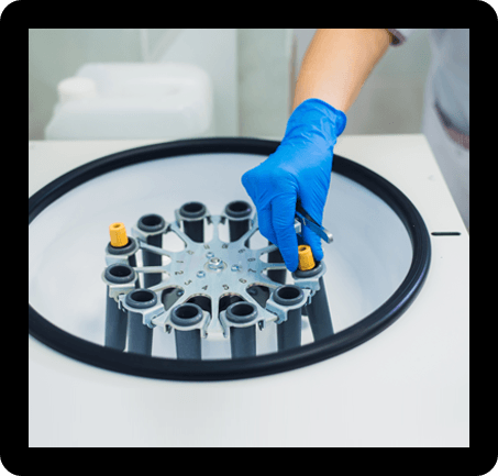 Bone Marrow Aspirate Concentrate Treatment