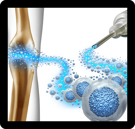 Platelet-Rich Plasma (PRP) Injection